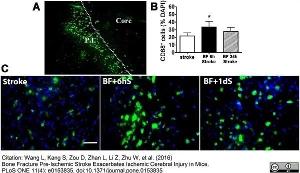 Anti Mouse CD68 Antibody, clone FA-11 gallery image 27