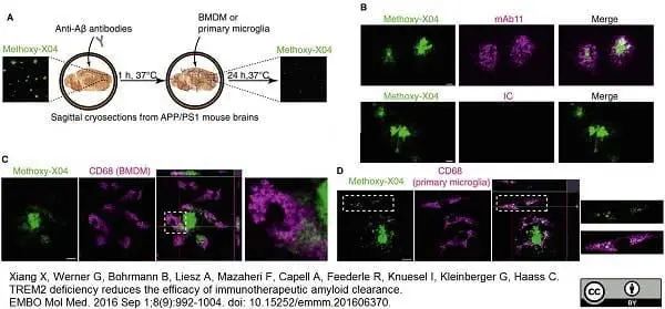 Anti Mouse CD68 Antibody, clone FA-11 gallery image 28