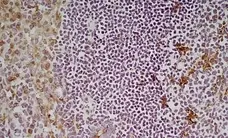 Anti Mouse CD68 Antibody, clone FA-11 gallery image 3