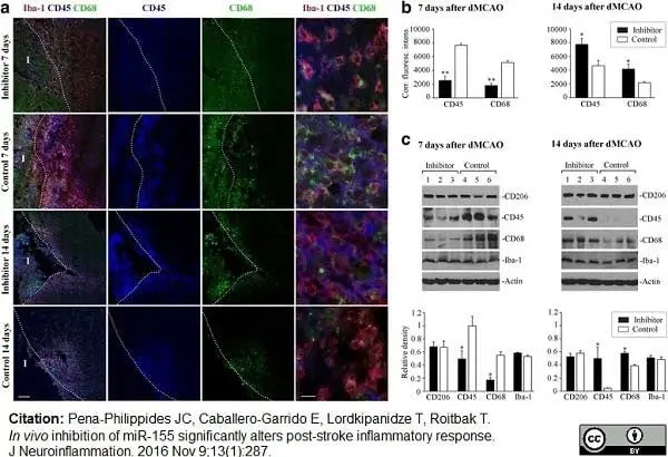 Anti Mouse CD68 Antibody, clone FA-11 gallery image 31