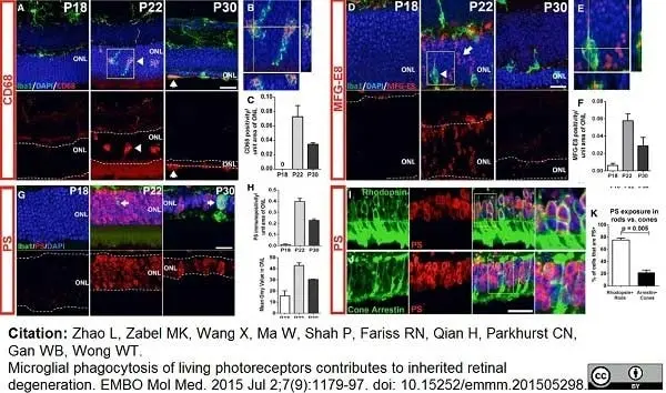 Anti Mouse CD68 Antibody, clone FA-11 gallery image 32