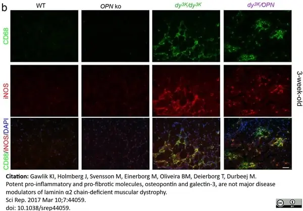 Anti Mouse CD68 Antibody, clone FA-11 gallery image 34