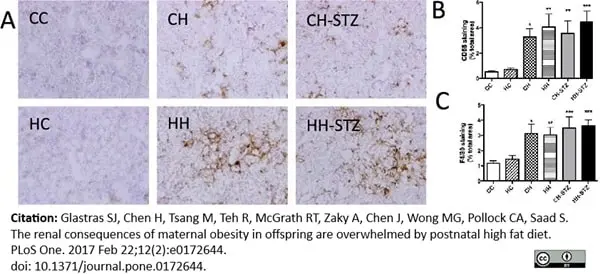 Anti Mouse CD68 Antibody, clone FA-11 gallery image 35