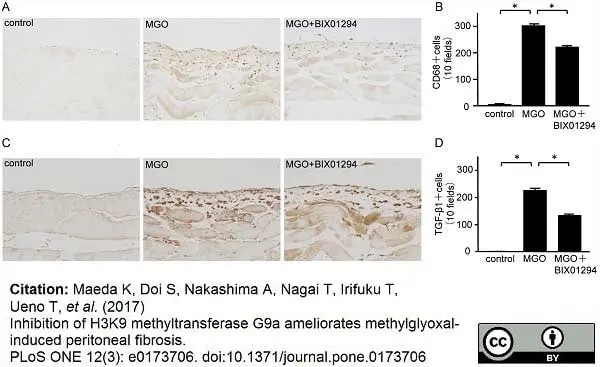 Anti Mouse CD68 Antibody, clone FA-11 gallery image 36