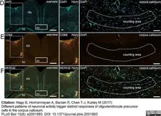 Anti Mouse CD68 Antibody, clone FA-11 gallery image 39