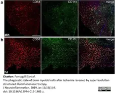 Anti Mouse CD68 Antibody, clone FA-11 gallery image 41