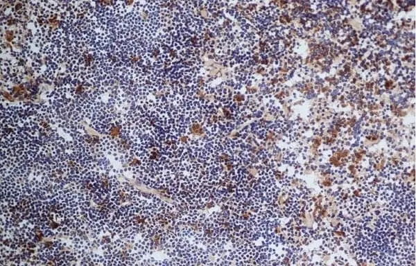 Anti Mouse CD68 Antibody, clone FA-11 gallery image 43