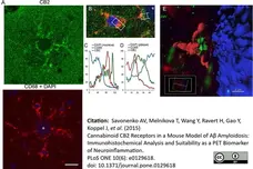 Anti Mouse CD68 Antibody, clone FA-11 gallery image 44