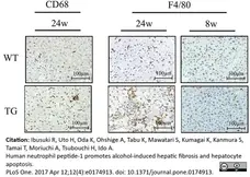 Anti Mouse CD68 Antibody, clone FA-11 gallery image 46