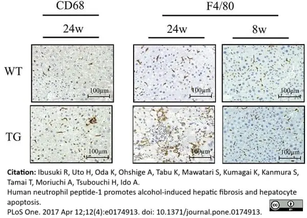Anti Mouse CD68 Antibody, clone FA-11 gallery image 46