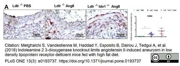 Anti Mouse CD68 Antibody, clone FA-11 gallery image 47