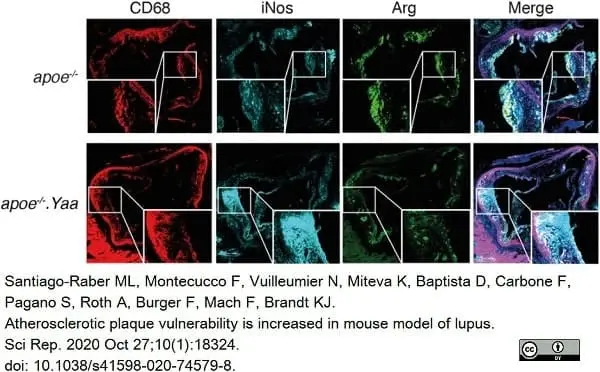 Anti Mouse CD68 Antibody, clone FA-11 gallery image 49