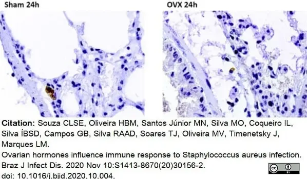 Anti Mouse CD68 Antibody, clone FA-11 gallery image 51
