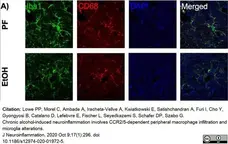 Anti Mouse CD68 Antibody, clone FA-11 gallery image 55
