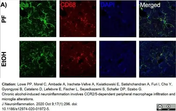 Anti Mouse CD68 Antibody, clone FA-11 gallery image 55