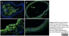 Anti Mouse CD68 Antibody, clone FA-11 gallery image 60