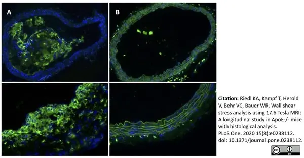 Anti Mouse CD68 Antibody, clone FA-11 gallery image 60