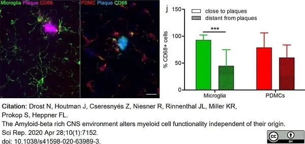 Anti Mouse CD68 Antibody, clone FA-11 gallery image 62