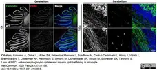 Anti Mouse CD68 Antibody, clone FA-11 gallery image 63
