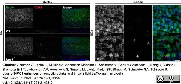 Anti Mouse CD68 Antibody, clone FA-11 gallery image 64