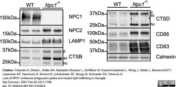 Anti Mouse CD68 Antibody, clone FA-11 gallery image 65