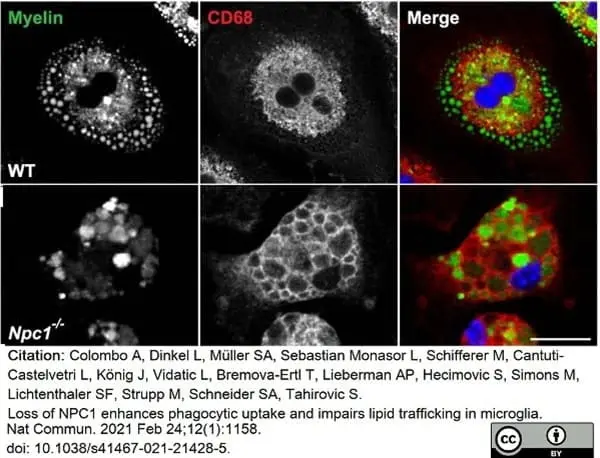 Anti Mouse CD68 Antibody, clone FA-11 gallery image 67