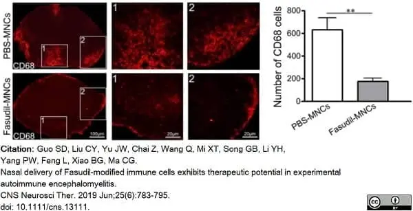 Anti Mouse CD68 Antibody, clone FA-11 gallery image 68
