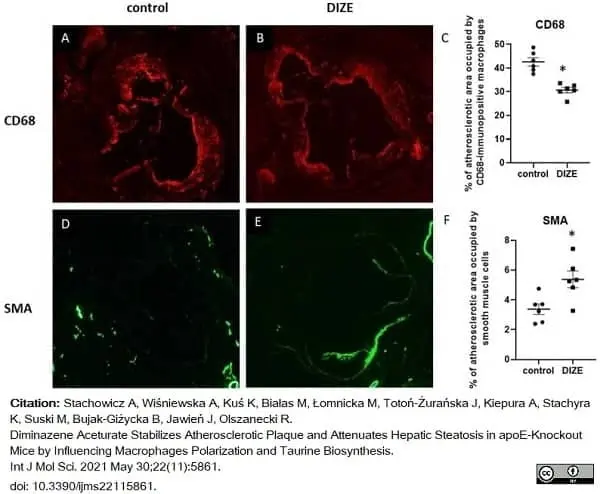 Anti Mouse CD68 Antibody, clone FA-11 gallery image 71
