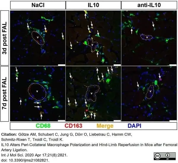 Anti Mouse CD68 Antibody, clone FA-11 gallery image 72