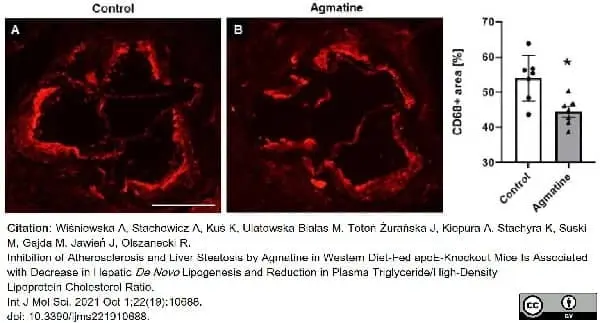 Anti Mouse CD68 Antibody, clone FA-11 gallery image 73
