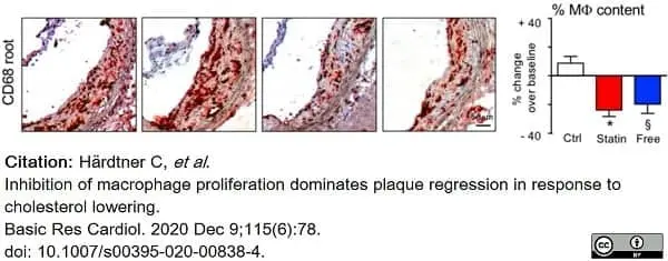 Anti Mouse CD68 Antibody, clone FA-11 gallery image 75
