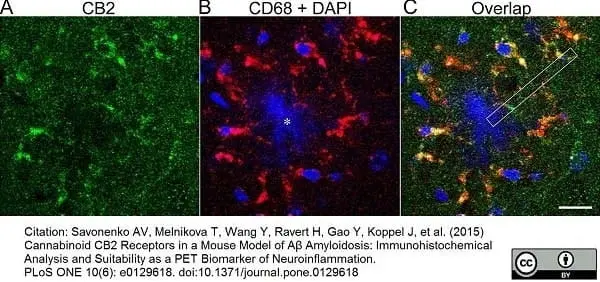 Anti Mouse CD68 Antibody, clone FA-11 gallery image 8