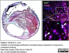Anti Mouse CD68 Antibody, clone FA-11 gallery image 80