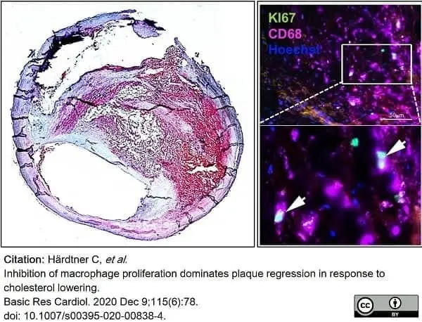 Anti Mouse CD68 Antibody, clone FA-11 gallery image 80