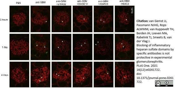 Anti Mouse CD68 Antibody, clone FA-11 gallery image 82