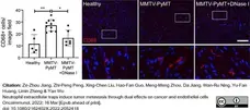 Anti Mouse CD68 Antibody, clone FA-11 gallery image 85