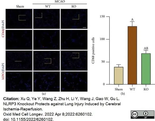 Anti Mouse CD68 Antibody, clone FA-11 gallery image 86