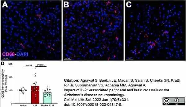 Anti Mouse CD68 Antibody, clone FA-11 gallery image 88
