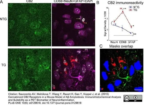 Anti Mouse CD68 Antibody, clone FA-11 gallery image 9