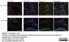 Anti Mouse CD68 Antibody, clone FA-11 gallery image 90