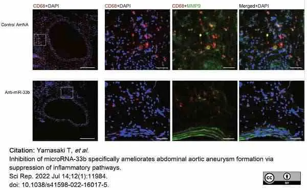 Anti Mouse CD68 Antibody, clone FA-11 gallery image 90