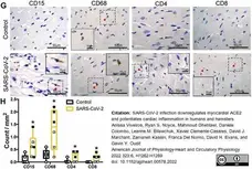 Anti Mouse CD68 Antibody, clone FA-11 gallery image 96