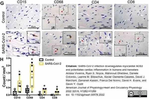 Anti Mouse CD68 Antibody, clone FA-11 gallery image 96