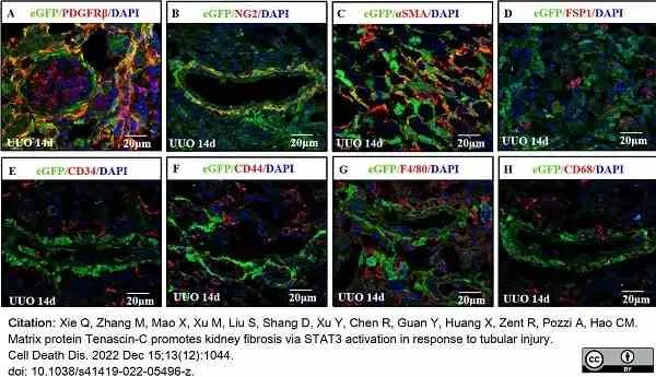 Anti Mouse CD68 Antibody, clone FA-11 gallery image 99