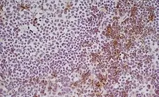 Anti Mouse CD8 Alpha Antibody, clone KT15 gallery image 6
