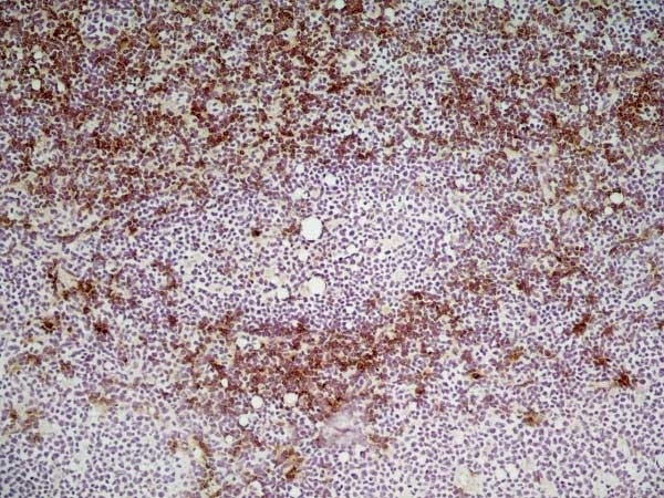 Anti Mouse CD8 Alpha Antibody, clone KT15 gallery image 5