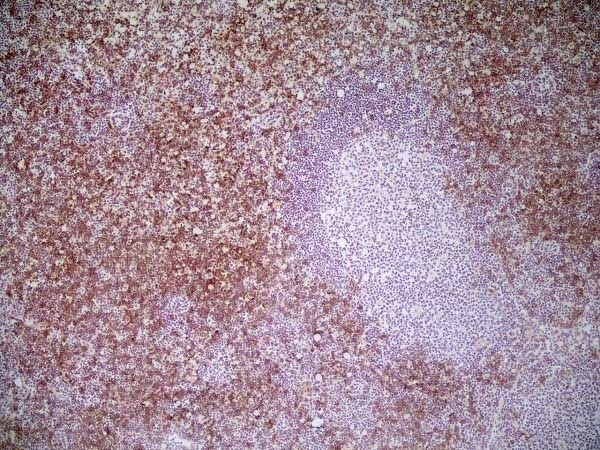 Anti Mouse CD8 Antibody, clone YTS105.18 gallery image 14