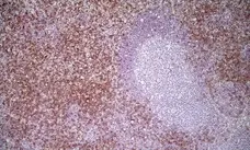 Anti Mouse CD8 Antibody, clone YTS105.18 gallery image 6