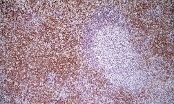 Anti Mouse CD8 Antibody, clone YTS105.18 gallery image 6