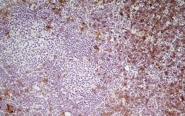 Anti Mouse CD8 Antibody, clone YTS105.18 gallery image 7